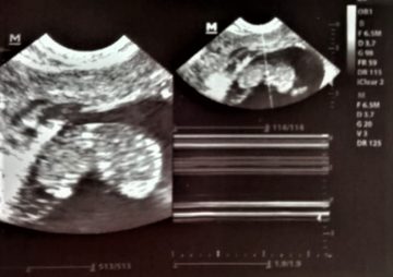 An ode to my lost babies