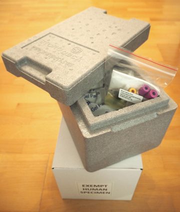 A non-invasive test that can detect cancer in your blood